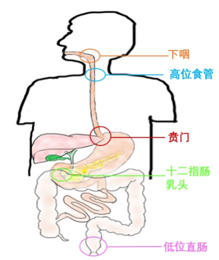 器官保留疗效好让患者绝处逢生ag旗舰厅平台内镜超级微创：(图9)