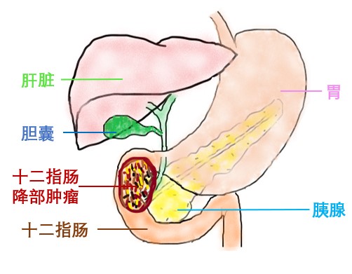 器官保留疗效好让患者绝处逢生ag旗舰厅平台内镜超级微创：(图10)