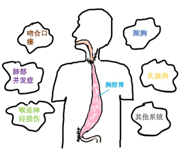 器官保留疗效好让患者绝处逢生ag旗舰厅平台内镜超级微创：(图7)